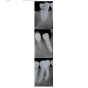 Owandy-RX Intraoral X-ray system 9459100105/9459100115 Intraoral X ray owandy-rx-intraoral-x-ray-system-9459100105 Dentamed USA Owandy-RX 
