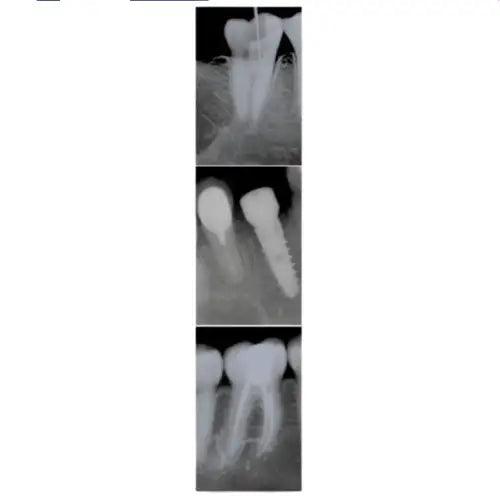 Owandy-RX Intraoral X-ray system 9459100105/9459100115 Intraoral X ray owandy-rx-intraoral-x-ray-system-9459100105 Dentamed USA Owandy-RX 