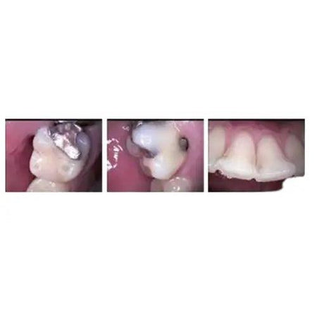 TPC Corded Camera & Docking Station System AIC5888-5925W-KT Cam Intraoral Camera tpc-corded-camera-docking-station-system-aic5888-5925w-kt